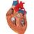 Corazón con bypass, 2 veces el tamaño natural, de 4 piezas - 3B Smart Anatomy, 1000263 [G06], Modelos de Corazón (Small)