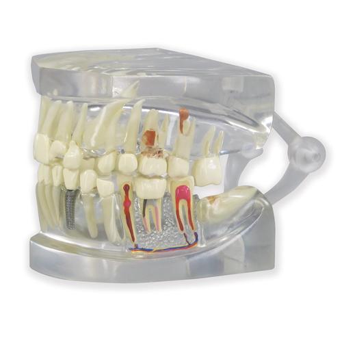 Modelo de mandíbula humana transparente con dientes, 1019540, Modelos dentales