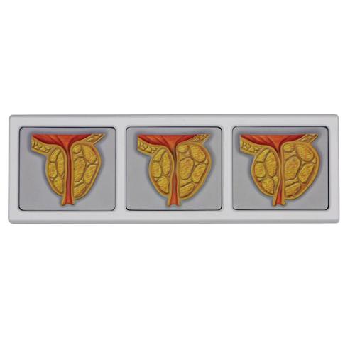 Pelvis masculina con imágenes de próstata en 3D, 1019563, Modelos de Pelvis y Genitales