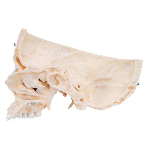 BONElike Cráneo – Cráneo óseo, 6 partes - 3B Smart Anatomy, 1000062 [A281], Modelos de Cráneos Humanos