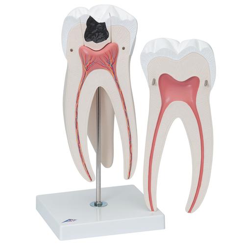 Molar superior, 6 piezas - 3B Smart Anatomy, 1013215 [D15], Modelos dentales