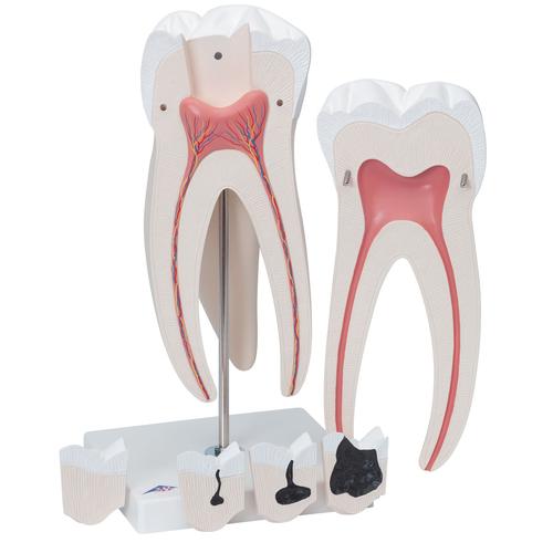 Molar superior, 6 piezas - 3B Smart Anatomy, 1013215 [D15], Modelos dentales