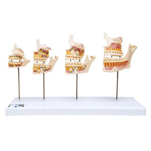 Desarrollo de la dentadura - 3B Smart Anatomy, 1000248 [D20], Modelos dentales