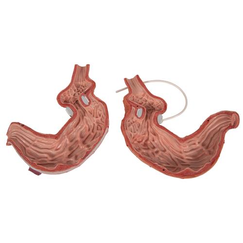 Modelo de banda gástrica - 3B Smart Anatomy, 1012787 [K15/1], Modelos del Sistema Digestivo