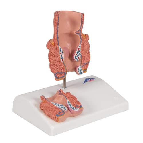 Modelo de hemorroides - 3B Smart Anatomy, 1000315 [K27], Modelos del Sistema Digestivo