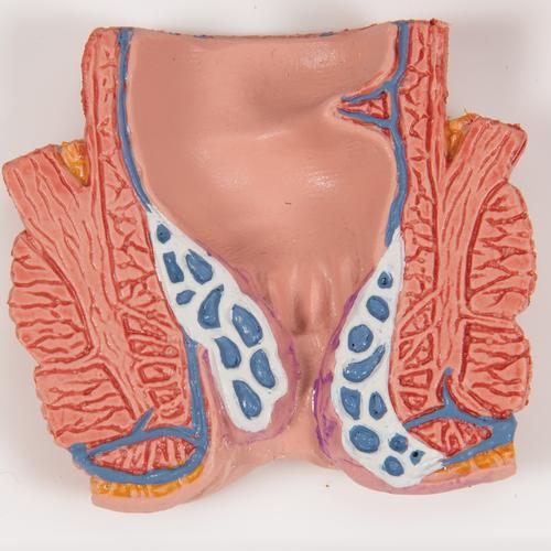 Modelo de hemorroides - 3B Smart Anatomy, 1000315 [K27], Modelos del Sistema Digestivo