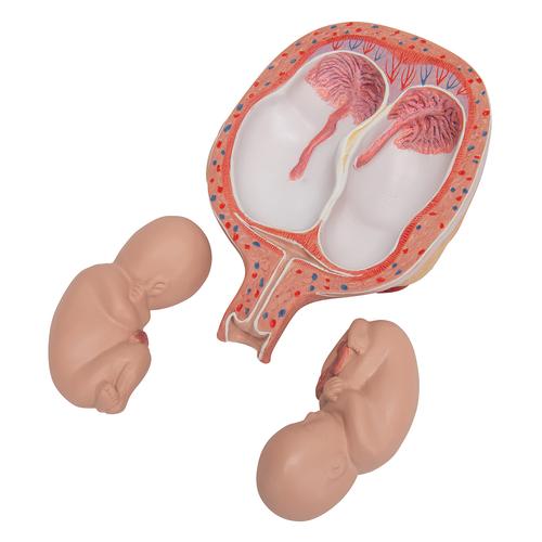 Fetos gemelos de 5 meses en posición normal L10/7 - 3B Smart Anatomy, 1000328 [L10/7], Modelos de Embarazo