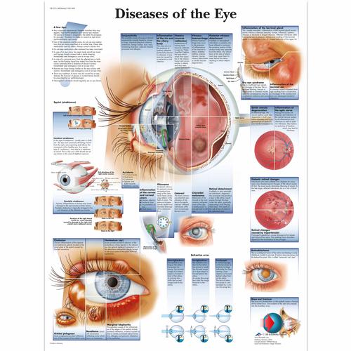 Diseases of the Eye, 1001498 [VR1231L], Ojos