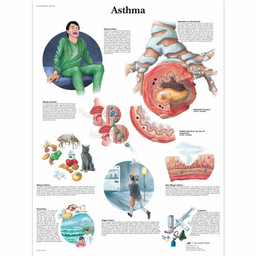 Asthma, 4006677 [VR1328UU], Educación sobre asma y alergias