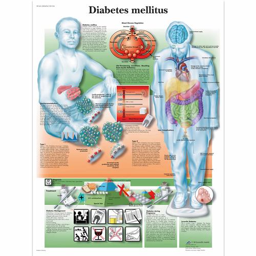 Diabetes mellitus, 4006694 [VR1441UU], Herramientas educativas para diabetes