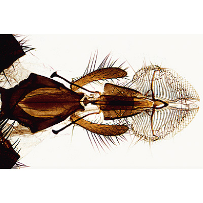 Insectos, Colección Elemental Ampliada - español, 1003870 [W13006S], Micropreparados LIEDER