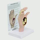 Modelo de mano con osteoartritis, 1019520, Modelos de esqueleto de brazo y mano