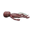 Bebé microprematuro / Pretérmino de peso extremadamente bajo al nacer (PEBN)
, 1024668, Simuladores Médicos