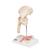 Fractura de fémur y desgaste de la articulación de la cadera - 3B Smart Anatomy, 1000175 [A88], Modelos de Articulaciones (Small)