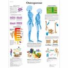 Osteoporose, 1001306 [VR0121L], Educación sobre artritis y osteoporosis