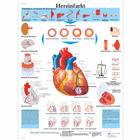 Herzinfarkt, 4006597 [VR0342UU], Educación sobre salud y fitness cardiacos