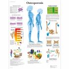 Pôster da Osteoporose, 4006653 [VR1121UU], Informações sobre artrite e osteoporose