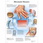 Rheumatic Diseases, 4006655 [VR1124UU], Sistema Esquelético