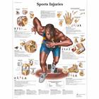 Sports Injuries, 1001494 [VR1188L], Músculo
