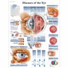 Diseases of the Eye, 1001498 [VR1231L], Ojos