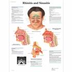 Rhinitis and Sinusitis, 1001504 [VR1251L], Oreja, Nariz, Garganta