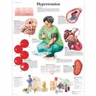 Pôster da Hipertensão, 4006683 [VR1361UU], Sistema Cardiovascular