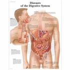 Pôster das Doenças do Sistema Digestivo, 4006691 [VR1431UU], Sistema digestivo