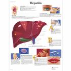 Hepatits, 1001552 [VR1435L], Sistema metabólico