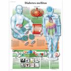 Pôster da Diabetes Mellitus, 1001554 [VR1441L], Sistema metabólico