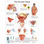 O Pôster da Próstata, 4006700 [VR1528UU], Educação: Saúde do Homem
