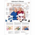 Alzheimer's Disease, 4006713 [VR1628UU], Cerebro y sistema nervioso