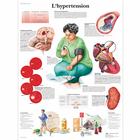 L'hypertension, 1001699 [VR2361L], Sistema Cardiovascular