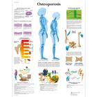 Osteoporosis, 4006816 [VR3121UU], Educación sobre artritis y osteoporosis