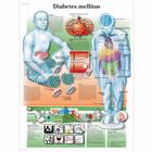 Diabetes mellitus, 4006857 [VR3441UU], Sistema metabólico