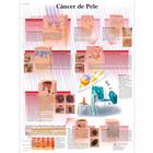 Cancer de Pele, 50x67 cm, Versão Papel, 4006993 [VR5295UU], Cânceres