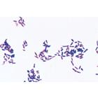 Bacterias Patógenas - alemán, 1004146 [W13324], Alemán