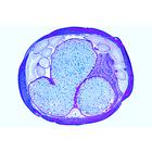 The Ascaris megalocephala Embryology, 1013479 [W13458], División celular