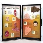 "As Consequências do Alcoolismo", Placa de Exposição 3D, 1005582 [W43053], Educação: Drogas e Álcool