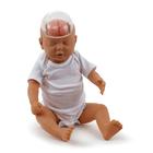 Modelo de bebé zarandeado, 1017928 [W43117], Cuidado del paciente neonato