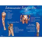 Póster de puntos de inyección intramuscular, 1018427 [W44783], Intramuscular (IM) e intradérmico